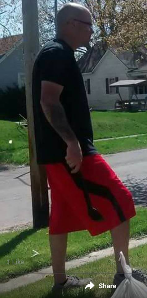 Robert Catlett Right Side Bald